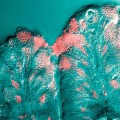 Zellen der Magenschleimhaut produzieren Schleim (rosa gefärbt)