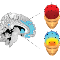 Das langfristige Speichern von Erinnerungen im Gehirn (links) erfolgt während des Tiefschlafs. Lässt dessen Qualität mit dem Altern nach (rechts oben), ist auch das Langzeitgedächtnis schlechter als bei jüngeren Menschen (rechts unten)