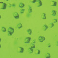 Lichtmikroskop-Aufnahme der Mikrokristalle Photosystem II, die in der Kombination von Röntgenbeugung und –emissionsspektroskopie am LCLS untersucht wurden. Der schwarze Strich entspricht 20 Mikrometern, die Kristalle sind im Durchmesser 15 Mikrometer groß