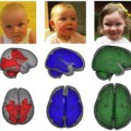Hirnscans der schlafenden Kinder aus dem Magnetresonanztomographen zeigen die Entwicklung der Weißen Substanz – Mark- oder Myelinscheiden der Nervenzellen – mit fortschreitendem Alter (von links nach rechts).