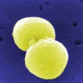 Pneumokokken (Streptococcus pneumoniae) bilden paarweise gelagerte Einzelzellen (gefärbte rasterelektronenmikroskopische Aufnahme).