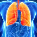 Eine Lungentransplantation ist die letzte Therapiemöglichkeit bei einer chronisch obstruktiven Lungenerkrankung (COPD), Mukoviszidose, Sarkoidose und anderen schweren Lungenkrankheiten.