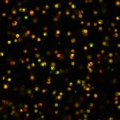 Fluoreszenzfarbstoffe zeigen an, ob Kalziumkonzentrationen in Knorpelzellen steigen (grün) oder sinken (rot).