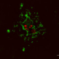 Mikroskopaufnahme von Lungenzellen, die in Gegenwart von Nanoteilchen aus Metalloxiden absterben.