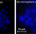 Fluoreszierende Nanopartikel unter einem Standardmikroskop ohne (links) und mit über der Probe verteilten Mikroperlen.