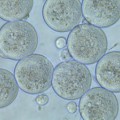 Eizellen von Mäusen nach Reagenzglasbefruchtung