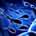 Das Sperma eines zeugungsfähigen Mannes enthält eine hohe Zahl schnell beweglicher, nicht deformierter Spermien.