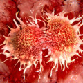 Krebszellen unterscheiden sich in ihren molekularen Profilen.