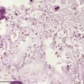 In einem Hundetumor haben sich aus Sporen hervorgegangene stäbchenförmige Clostridium novyi-Bakterien vermehrt.