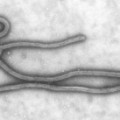 Transmissionselektronenmikroskopische Aufnahme des Ebola-Virus