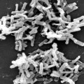 Clostridien sind anaerobe, sporenbildende Stäbchenbakterien, die in der Umwelt verbreitet und Teil der normalen Darmflora sind. (Rasterelektronenmikroskopische Aufnahme von Clostridium difficile aus einer Stuhlprobe)
