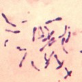 Corynebakterien sind normale Hautkeime und finden sich auch auf Oberflächen in der Wohnung.