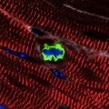 Herzmuskelzelle, die ihre Vermehrungsfähigkeit durch MikroRNA miR302-367 wiedererlangt hat (durch Färbung sichtbar gemacht)