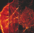 Cytoskelett einer lebenden Zelle unter einem Fluoreszenz-Mikroskop (SIM)