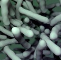 Clostridium difficile ist ein sporenbildendes Stäbchenbakterium, das in geringer Zahl auch im Darm gesunder Menschen vorkommt.