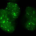 Exosome von Tumoren (leuchtend grün) verschmelzen mit Lungenzellen von Mäusen (digital bearbeitet).