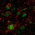 E. coli-Proteine aktivieren appetithemmende Neuronen (grün) im Hypothalamus von Ratten.