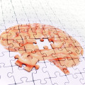 Bei Alzheimer lässt die geistige Leistungsfähigkeit immer mehr nach.