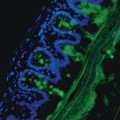 Die Becherzellen (blau) der Darmwand produzieren Schleim (grün) als eine Barriere, die das Eindringen schädlicher Bakterien verhindert.