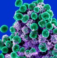 Rasterelektronenmikroskopische Aufnahme von Staphylococcus epidermidis (grün gefärbt)