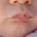 In den ersten Lebensjahren entwickelt sich ein Mund-Mikrobiom, das dem der Eltern und Geschwister gleicht, da Keime über den Speichel ausgetauscht werden.
