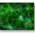 Mikroskopaufnahme einer Kultur aus Nervenzellen, deren Aktivität sich über designte Lichtpulse steuern lassen könnte.
