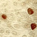 Chlamydien (braun gefärbte Einschlusskörperchen) leben als Parasiten im Innern von Wirtszellen.