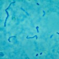 Fusobakterien zählen zur normalen Körperflora von Mundhöhle und Darm (Fusobacterium necrophorum im Phasenkontrastmikroskop).