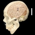 Menschlicher Schädel mit eingezeichnetem Gehirn
