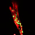 Durch ein Hydrogel übertragene Muskelstammzellen (Satellitenzellen, grün) haben sich an eine Muskelfaser (rot) angeheftet.