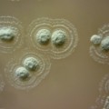 Kolonien der neu entdeckten Keimart Streptomyces myrophorea