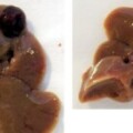 In männlichen Mäusen entwickeln sich durch Erhöhung des Adiponektin-Spiegels kleinere Lebertumore (rechts) als in normalen Tieren (links).