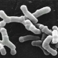 Bifidobacterium longum im Elektronenmikroskop