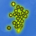 Transmissionselektronenmikroskopische Aufnahme von Influenza-A-Viren vom Typ H1N1 (digital koloriert)