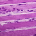 Lichtmikroskopisches Längsschnittbild quergestreifter Muskelfasern (Hämatoxylin-Eosin-Färbung)