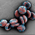 Mit Krebsmittel gefüllte Nanopartikel (blau) haften an roten Blutkörperchen einer Maus (rasterelektronenmikroskopische Aufnahme, koloriert).