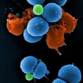 Rasterelektronenmikroskopische Aufnahme von intakten (blau) und durch PK150 zerstörten (rot) Zellen von multiresistenten Staphylococcus aureus (MRSA)