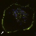 Fluoreszenzmarkierte Komplexe aus Clusterin und fehlgefaltetem Protein auf der Oberfläche der Zellmembran