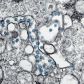 Corona-Viren (blau) in einer Probe des ersten Covid-19-Falls in den USA, aufgenommen mit einem Transmissionselektronenmikroskop.