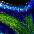Nasenschleimhautzellen einer Maus, 14 Tage nach Infektion mit Influenzaviren (rot: Zellen nach überstandener Infektion, grün: Riechzellen, gelb: Riechzellen nach überstandener Infektion)