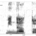 Ein Spektrogramm zeigt den zeitlichen Verlauf gesprochener Tonfrequenzen.