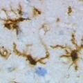 Eine Fehlfunktion von Mikrogliazellen (braun gefärbt) könnte das Nachlassen geistiger Fähigkeiten im Alter verursachen.